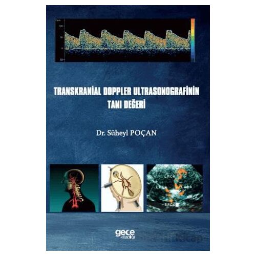Transkranial Doppler Ultrasonografinin Tanı Değeri - Süheyl Poçan - Gece Kitaplığı